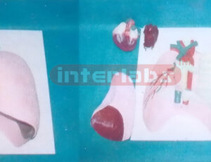 NATURAL LUNG MODEL CONTAINS LARYNX