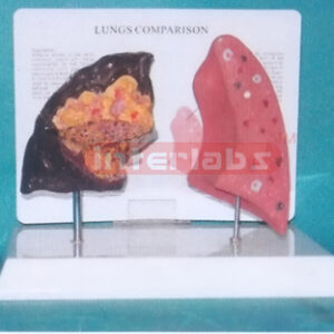 HEALTH AND DISEASE LUNGS COMPARISON MODEL Manufacturers and Suppliers From Ambala India