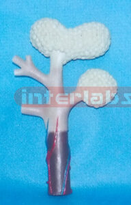 BRONCHIOLES Manufacturers and Suppliers From Ambala India