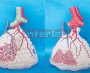 MAGNIFIED LUNG LOBULE MODEL WITH PULMONARY ALVEOLI Manufacturers and Suppliers From Ambala India