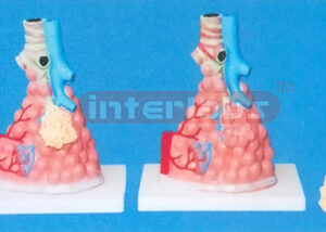 BIG MAGNIFIED PULMONARY ALVEOLI MODEL WITH CANCER Manufacturers and Suppliers From Ambala India