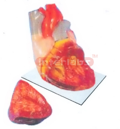 INDO-TYPE BIG HEART MODEL Manufacturers and Suppliers From Ambala India
