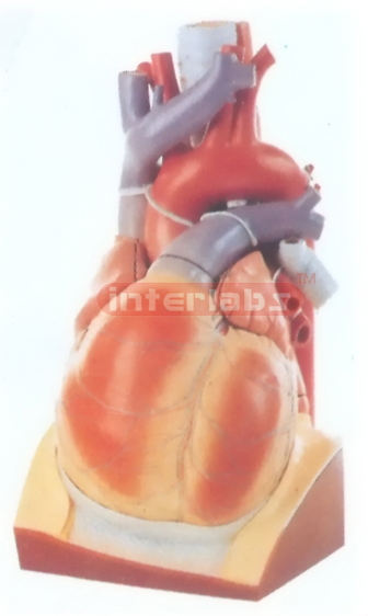 BIG ENLARG ED HEART MODEL APPROX