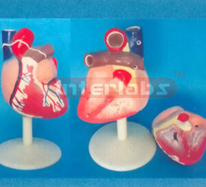 MIDDLE MAGNIFIED HEART