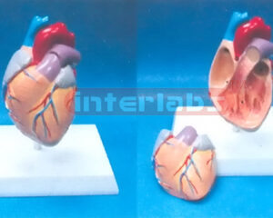 MIDDLE-SMALLADULTANATHEART MODEL WISHORT VESSEL Manufacturers and Suppliers From Ambala India