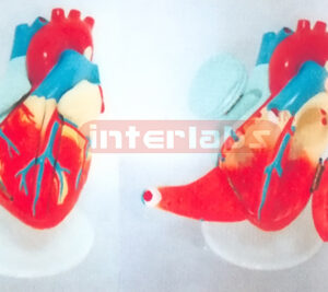 MIDDLE ADVANCED HEART MODEL Manufacturers and Suppliers From Ambala India