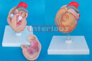 DISEASE HEART WITH LEFT VENTRICULAR HYPERTROPHY (LVH) Manufacturers and Suppliers From Ambala India