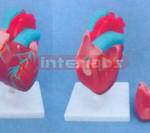 SMALL MIDDLE HEART MODEL