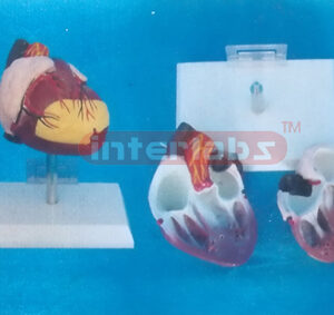 ANATOMICAL HEART MODEL OF 108CM MUSCLE TORSO Manufacturers and Suppliers From Ambala India