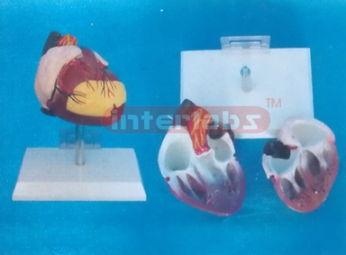 ANATOMICAL HEART MODEL OF 108CM MUSCLE TORSO Manufacturers and Suppliers From Ambala India