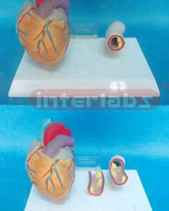 MIDDLE HEART MODEL WITH DISEASE BLOOD TUBE Manufacturers and Suppliers From Ambala India