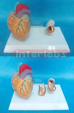 MIDDLE HEART MODEL WITH DISEASE BLOOD TUBE Manufacturers and Suppliers From Ambala India