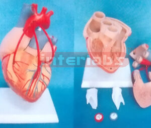 MIDDLE DISEASE HEART MODEL WITH BYPASS Manufacturers and Suppliers From Ambala India