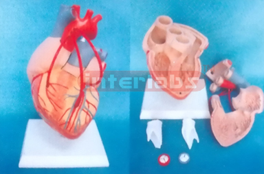 MIDDLE DISEASE HEART MODEL WITH BYPASS Manufacturers and Suppliers From Ambala India