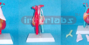 NATURAL ANATOMICAL HEART WITH LONG VESSEL. THYMUS THRACHEA & SOPHAGUS AND PLASTIC BASE. Manufacturers and Suppliers From Ambala India