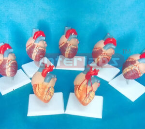 HUMAN HEART MODEL OF CONGENITAL MALFORMATION DISEASES Manufacturers and Suppliers From Ambala India