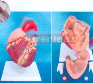MIDDLE HEART WITH VENTRICULAR SEPTAL DEFECT Manufacturers and Suppliers From Ambala India