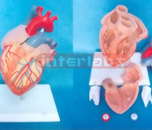 MIDDLE HEALTH HEART MODEL Manufacturers and Suppliers From Ambala India