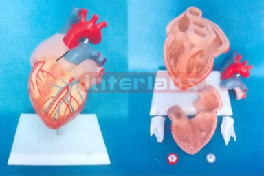 MIDDLE HEALTH HEART MODEL Manufacturers and Suppliers From Ambala India
