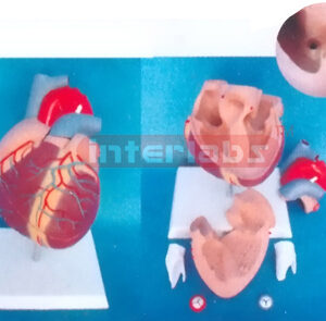 MIDDLE HEART WITH ATRIAL SEPTAL DEFECT Manufacturers and Suppliers From Ambala India