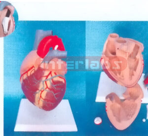 MIDDLE HEART WITH PULMONARY ARTERY STENOSIS Manufacturers and Suppliers From Ambala India