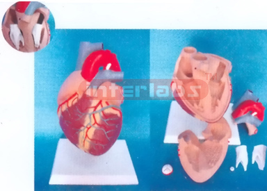 MIDDLE HEART WITH PULMONARY ARTERY STENOSIS Manufacturers and Suppliers From Ambala India