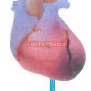 HEART FAILURE MODEL Manufacturers and Suppliers From Ambala India
