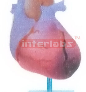 MYOCARDIAL INFARCTION MODEL Manufacturers and Suppliers From Ambala India