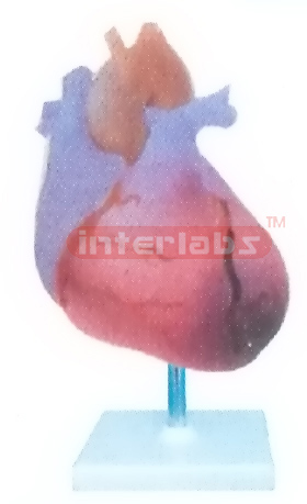 MYOCARDIAL INFARCTION MODEL Manufacturers and Suppliers From Ambala India