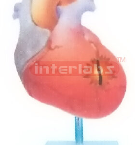 LEFT VENTRICULAR HYPERTROPHY MODEL Manufacturers and Suppliers From Ambala India
