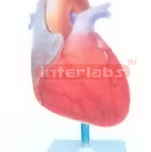 INCREASE IN MYOCARDIAL WALL TENSION MODEL Manufacturers and Suppliers From Ambala India