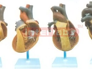 HUMAN COMMON PATHOLOGIES OF CONGENITAL ORGANIC HEART DEFECTS WITH VERTICAL STAND Manufacturers and Suppliers From Ambala India