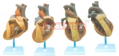 HUMAN COMMON PATHOLOGIES OF CONGENITAL ORGANIC HEART DEFECTS WITH VERTICAL STAND Manufacturers and Suppliers From Ambala India