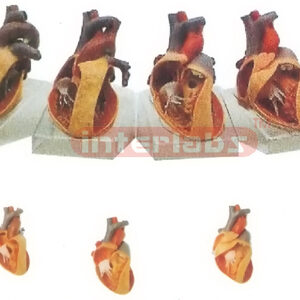 HUMAN COMMON PATHOLOGIES OF CONGENITAL ORGANIC HEART DEFECTS WITH HORIZONTAL BASE Manufacturers and Suppliers From Ambala India
