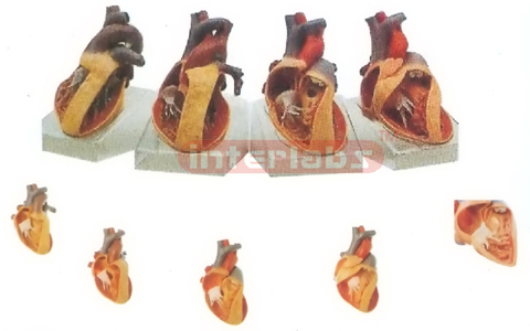 HUMAN COMMON PATHOLOGIES OF CONGENITAL ORGANIC HEART DEFECTS WITH HORIZONTAL BASE Manufacturers and Suppliers From Ambala India