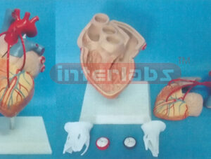 MIDDLE ADULT DISEASE HEART MODEL WITH BYPASS Manufacturers and Suppliers From Ambala India