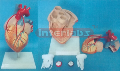 MIDDLE ADULT DISEASE HEART MODEL WITH BYPASS Manufacturers and Suppliers From Ambala India