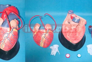 BIG MAGNIFIED ANATOMICAL HEARTPUTS UP A BRIDGE