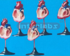 MODEL OF CONGENITAL MALFORMATION HEART Manufacturers and Suppliers From Ambala India