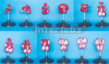 HUMAN DEVELOPMENT MODEL OF THE HEART Manufacturers and Suppliers From Ambala India