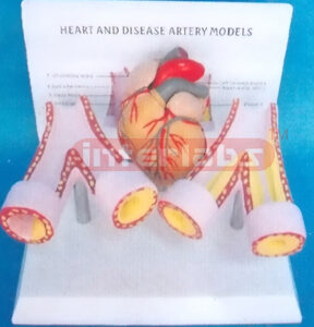 HEART AND DISEASE ARTERY MODELS Manufacturers and Suppliers From Ambala India