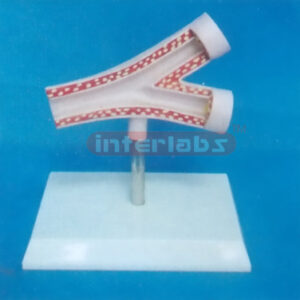 HEALTH ARTERY MODEL WITH PLASTIC BASE Manufacturers and Suppliers From Ambala India