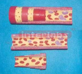 HUMAN ARTERY ANATOMY BLOOD CELL MODEL Manufacturers and Suppliers From Ambala India