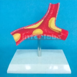 DESK TYPE DISEASE ARTERY MODEL WITH DESCRIPTION PLATE Manufacturers and Suppliers From Ambala India