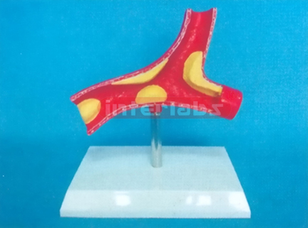 DESK TYPE DISEASE ARTERY MODEL WITH DESCRIPTION PLATE Manufacturers and Suppliers From Ambala India