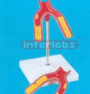 DISEASE ARTERY MODEL Manufacturers and Suppliers From Ambala India