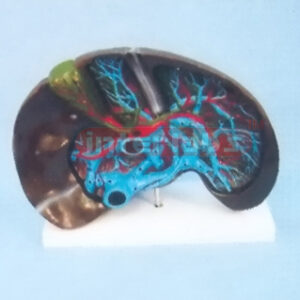 SUPER LIVER MODEL Manufacturers and Suppliers From Ambala India