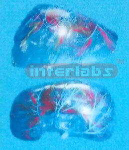 TRANSPARENT LIVER SEGMENTS (A TYPE) Manufacturers and Suppliers From Ambala India