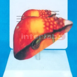 DESK TYPE HUMAN COMMON PATHOLOGIES OF LIVER MODEL WITH DESCRIPTION PLATE Manufacturers and Suppliers From Ambala India