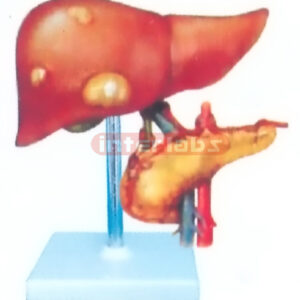 CANCER DISEASE LIVER AND PANCREAS MODEL WITH DESCRIPTION PLATE Manufacturers and Suppliers From Ambala India